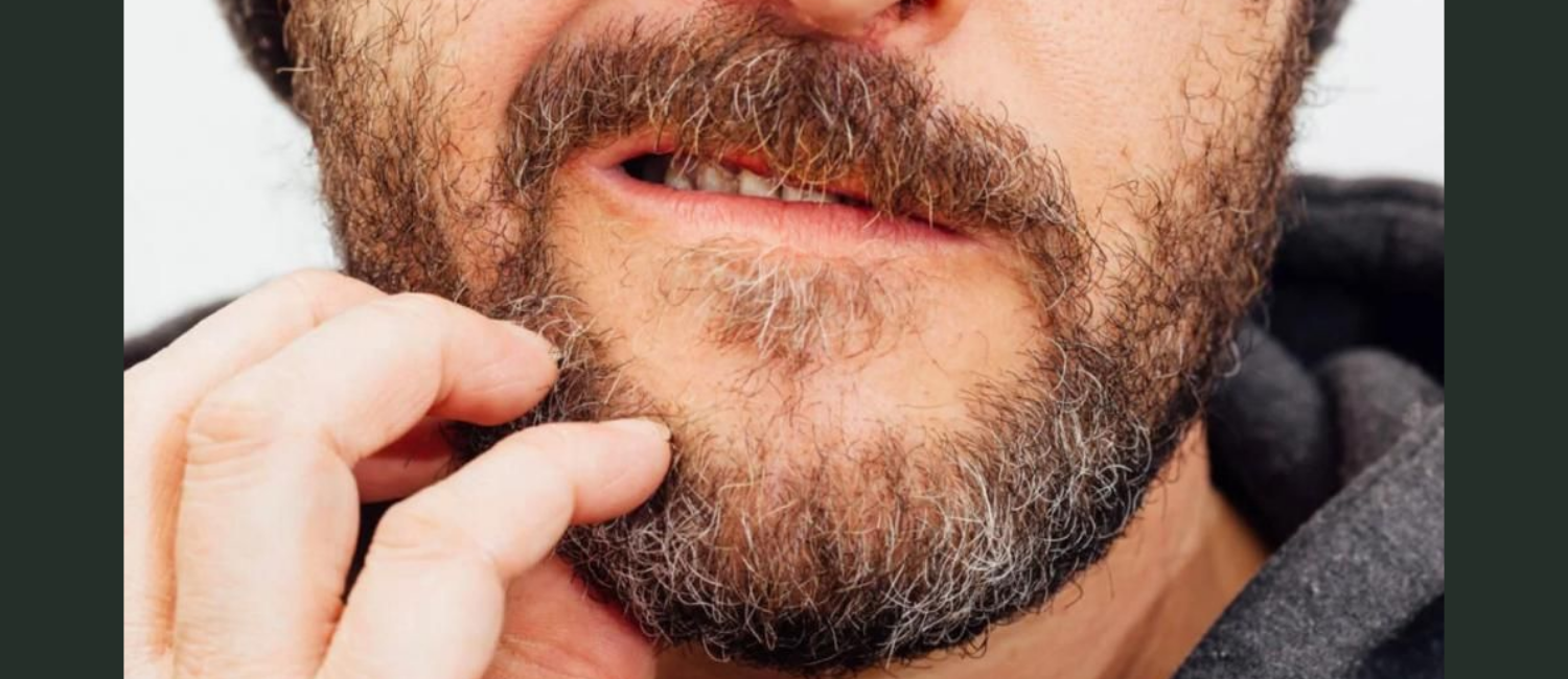 The Dreaded Beardruff (And How to Get Rid of It)
